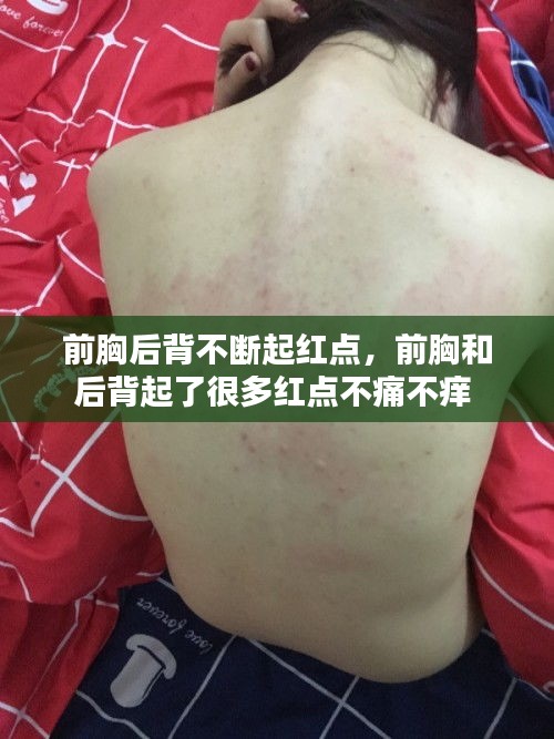 前胸后背不断起红点,前胸和后背起了很多红点不痛不痒